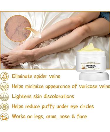 Fivfivgo & Creamvital Varicose Veins Miracle Cream | Effective Pain Relief & Treatment for Legs | Spider Vein Solutions - Buy Online on GoSupps.com