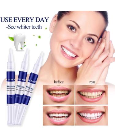 3PC Tooth Whitening Pen Kit - Effective Bleaching & Stain Removal (Peroxide-Free) for Whiter Teeth - Buy Online on GoSupps.com