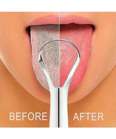 ZIRYXQ Y-Kelin Stainless Steel Tongue Scraper - Eco-Friendly Reusable Brush for Fresh Breath | International Shipping - Buy Online on GoSupps.com