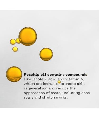 Attirent Organic Rosehip Oil - 30 ml - Pure Rosehip Seed Oil for Hydrating Nourishing & Moisturizing - Oil for Hair Skin & Nails - Buy Online on GoSupps.com