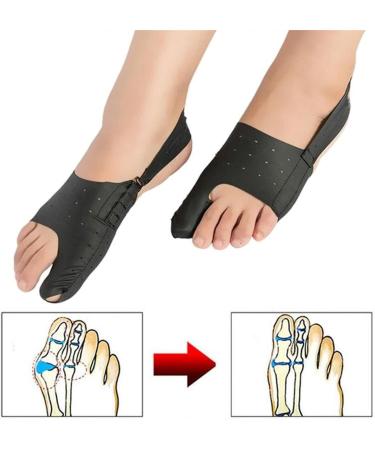 WXHZHQ Toe Spreader & Bunion Corrector - Hallux Valgus Relief Foot Pain Care Orthosis (Black Size S) - Day & Night Support - Buy Online on GoSupps.com