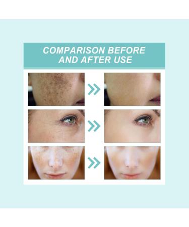 Dark Spot Remover for Face & Body - Effective Fast-Acting Solution | Shop Internationally - Buy Online on GoSupps.com