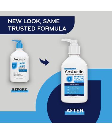 AmLactin Crepe Firming Cream - 12 oz Body Cream with 15% Lactic Acid - Exfoliator and Moisturizer & Intensive Healing Body Lotion for Dry Skin 14.1 oz Pump Bottle 2-in-1 Exfoliator - Buy Online on GoSupps.com