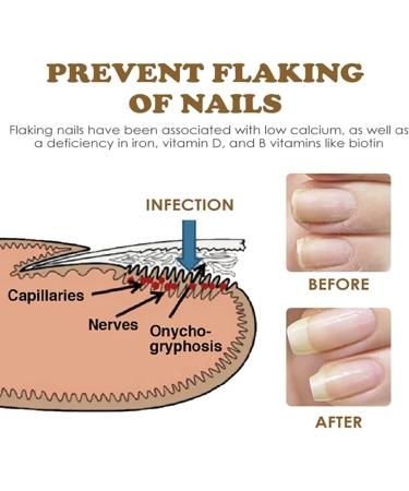 NailGrowth DeepHealing Organic Serum NailGrowth Nail Serum Reconstrux Nail Growth Nail Growth and Strengthening Serum Nail Serum for Growth and Repair for Damaged Nails (3pcs) - Buy Online on GoSupps.com