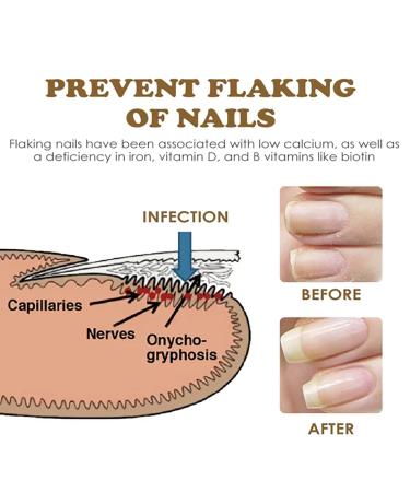 Nailgrowth Deep Healing Organic Serum - Strengthening & Repair Nail Serum for Growth | 3PCs - Buy Online on GoSupps.com
