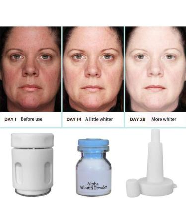 Symeas Alpha Arbutin Powder Renew Skin Anti-aging Serum Powder Repair Sunburn Skin Reduce Diminish Acne Treatment Pigmentations Life Spots - Buy Online on GoSupps.com