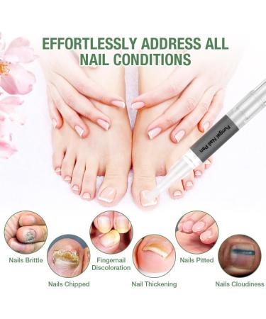 2 Pi ces Stylos Huile pour Cuticules Ongles Nail Care Pen avec Huile d'arbre Th pour l'huile et Renforcer de Cuticule S che R parer les Fissures et Am liorer l apparence des Ongles Vert 2pcs - Buy Online on GoSupps.com