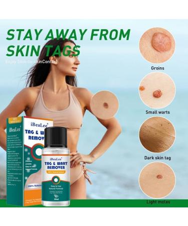 Wart Remover Liquid - Fast & Effective Treatment for Plantar & Common Warts | Safe Botanical Formula - Buy Online on GoSupps.com