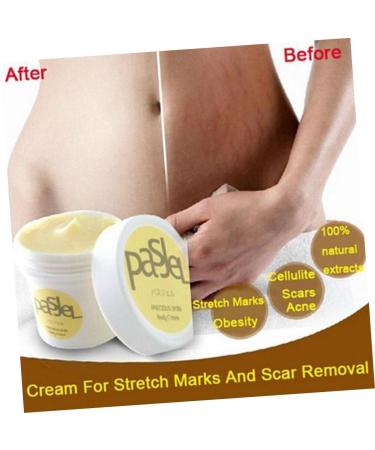 minkissy 2pi ces Cr me R paratrice Pour Vergetures De Grossesse Hydratation Et lasticit Peau Soin Naturel Anti-cicatrices comme indiqu x2pcs mediumx2pcs - Buy Online on GoSupps.com