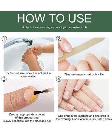 Antifungal Nail Treatment for Damaged Nails - Toe Care Solution for Renewing Discolored Feet - Buy Online on GoSupps.com