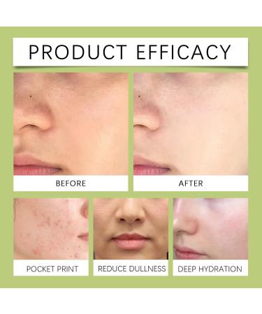 Facial Toner For Skin Care - Improves Elasticity Controls Oil Refreshes Deep Cleans Pores & Balances Sebum(2PCS) - Buy Online on GoSupps.com