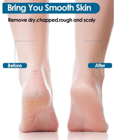 GJCrafts Paraffin Wax Bath for Hands and Feet - Promotes Blood Circulation, Removes Dry Skin - 3Pcs 300g Wax + 200 Plastic Foils - Buy Online on GoSupps.com