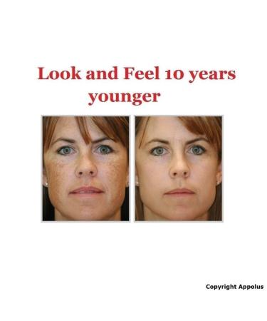 Appolus Premium Diamond Microdermabrasion Machine for Flawless Skin - 2 Diamond Tips - 5 Heads - Blackhead Blemish Remover - Pore Minimizer - Wrinkle Reduction - Sagging Skin Treatment - Silver - Buy Online on GoSupps.com