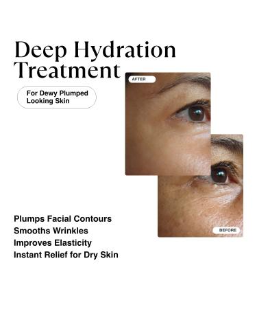 MATKAS Korean Triple Hyaluronic Acid Serum with Niacinamide, Peptides, and Vitamins for Firm, Hydrated, and Youthful Skin - Buy Online on GoSupps.com