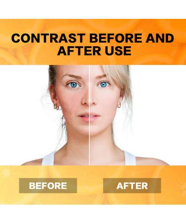 Organic Vitamin C Serum with Hyaluronic Acid | Anti Aging, Dark Circles & Sun Damage Corrector - Buy Online on GoSupps.com