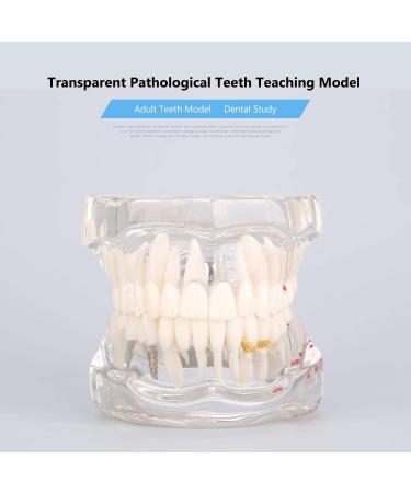 Teeth Model for Dental Teaching & Research | Realistic Adult Teeth Demonstration | No Brand - Buy Online on GoSupps.com