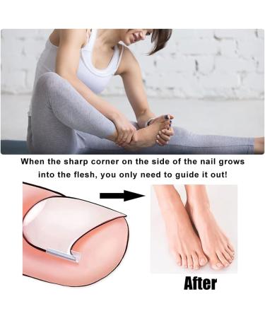 Toenail Corrector Patch Ingrown Nail Corrector Ingrown Nail Treatment Ingrown Nail Corrector Stickers Toenail Correction Toenail Patch - Buy Online on GoSupps.com