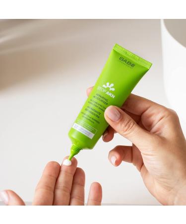 Stop Akn Moisturising Repairing Cream 50ml - Hydrating Acne Treatment - Buy Online on GoSupps.com