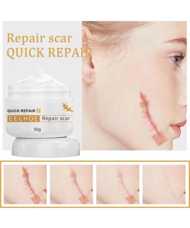 Scar Removal Stretch Marks & Burns Relief Facial Moisturizer - Sensitive Skin | White One Size - Buy Online on GoSupps.com