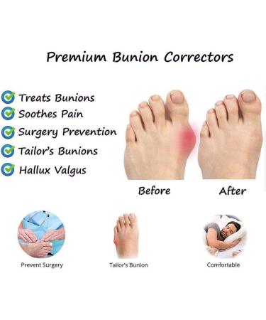 Creev Women s Platform Wedge Sandals for Big Toe Correction | Summer Travel Slippers (EU 35-38) - Buy Online on GoSupps.com