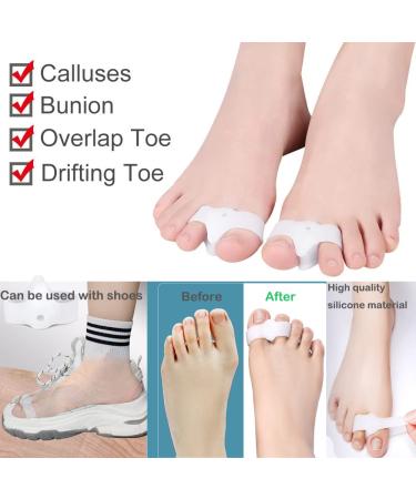 Bunion Corrector 8 Pack for Women and Men - Toe Separator Pain Relief Sleeves Kit - Overlapping Toes Straightener Set - Buy Online on GoSupps.com
