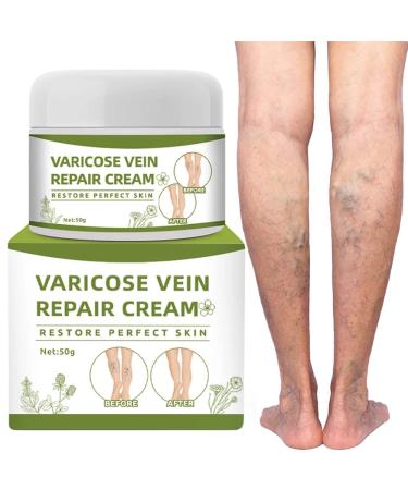 Varicose Veins Cream Spider Veins Repair Cream Varicose & Spider Veins Leg Cream Varicose Vein Treatment Cream for Legs (50g)
