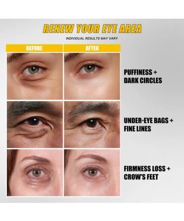 Instant Bright Eye Cream Under Eye Tightener for Bags & Wrinkles Anti-Aging Dark Circles Lifting Smooth Fine Lines Eye Treatment with Retinol Caffeine & Niacinamide - Buy Online on GoSupps.com