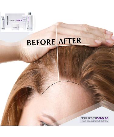 Tricomax Scalp Therapy - Hair Regrowth Stimulant & Thickener with Vitamin E - Reduce Inflammation - 118 ml/4 oz - International Shipping Available - Buy Online on GoSupps.com