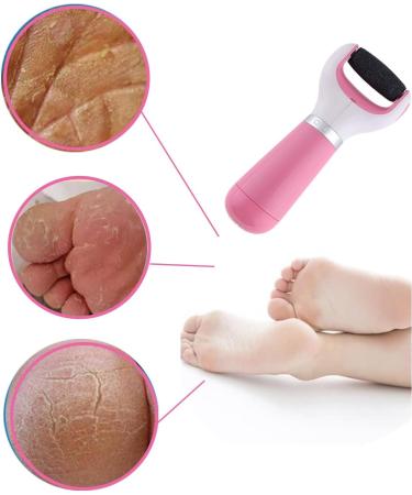 Electric Callus Remover for Feet - USB & Battery Powered Foot Buffer Tool with Pink Roller for Smooth Pedicures - International Shipping Available - Buy Online on GoSupps.com
