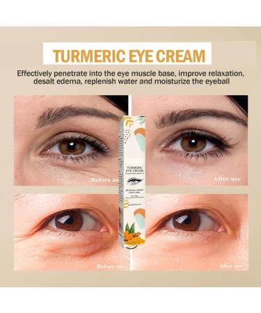 Turmeric Eye Cream for Dark Circles Anti-Aging Moisturizer Eye Treatment Cream to Reduce Puffiness and Fine Lines - Buy Online on GoSupps.com
