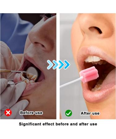 Sportway 100 Disposable Oral Sponges - Sterile Mouthparts for Dental Care Portable & Easy to Use - Buy Online on GoSupps.com