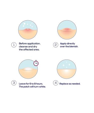 Hanhoo On the Go Blemish Patch - Hydrocolloid Spot Treatment for Acne (108 Count) - Buy Online on GoSupps.com