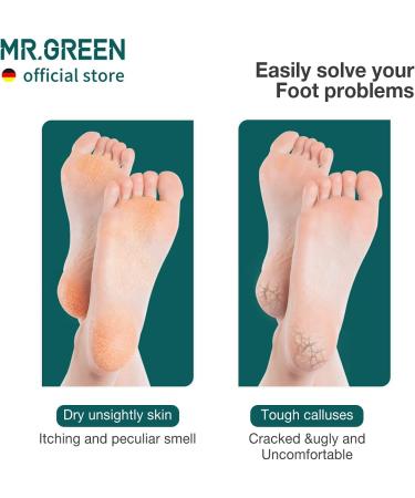 MR.GREEN Foot File for Hard Skin and Calluses Foot File Double Sided Professional Stainless Steel Pedicure Foot Care Tool Foot Scraper(Orange) - Buy Online on GoSupps.com