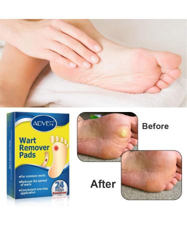 24Pcs WartRemover Pads Foot Corn Removal Plaster with Hole Penetrates and Removes Common and Plantar Warts 2023 New Warts Off Removal Pads for All Skin Types - Buy Online on GoSupps.com