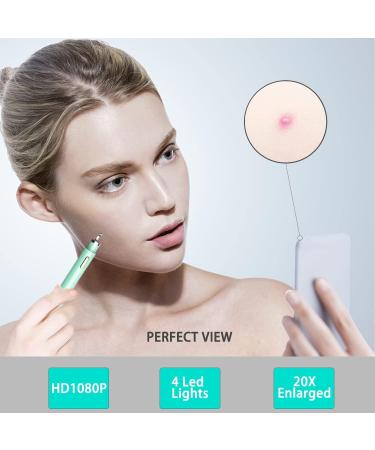 Visible Blackhead Remover with Camera Advanced Pimple Popper with Camera Acne Comedone Whitehead Extractor Kit Skin Care Pore Clean Tool - Buy Online on GoSupps.com
