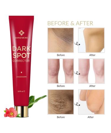 Dark Spot Corrector Cream for Body, Underarms, Elbows, Neck, Legs, Inner Thighs & Intimate Areas - Dark Spot Remover Treatment - Buy Online on GoSupps.com