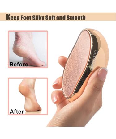 Nano Glass Foot File Callus Remover - G.Liane Crystal Glass Pedicure Foot Care Scrubber for Hard Skin Removal (Gold) - Buy Online on GoSupps.com