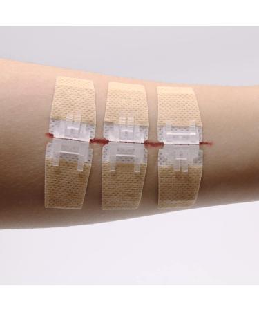 Longmed Emergency Wound Closures - Butterfly Adhesive Bandages - 3 Pieces - Buy Online on GoSupps.com