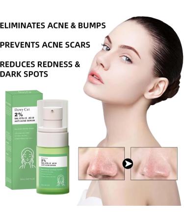 Salicylic Acid Solution Salicylic Acid 2% Solution Gentle Exfoliating Serum for Smoother & Clearer Skin Daily Use Facial Serum (20 mL) - Buy Online on GoSupps.com
