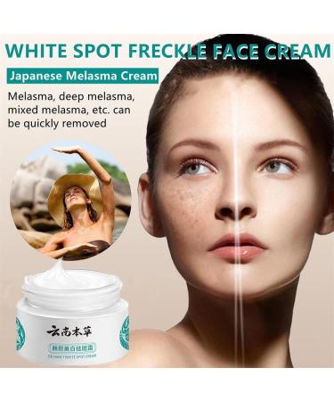 Cr me pour le visage Melasma Taches de rousseur Cr me r novatrice pour la peau fonc e Cr me cosm tique pour le visage peau noire Yunnan Japanese Melasma Cream For All Skin Types (1pcs) - Buy Online on GoSupps.com