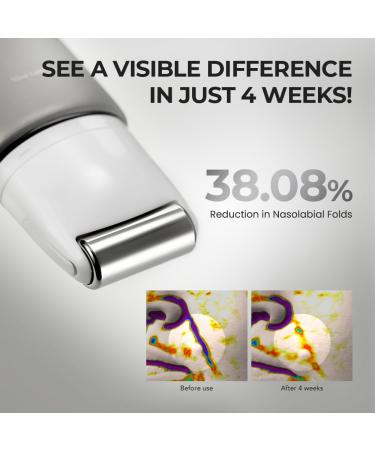  SKIN&LAB Retinol Lifting Roller Cream with Massage applicator Vegan Anti Aging Face and Neck Cream for Reduce Wrinkles and Fine Line For Face Neck D collet Wrinkle Care 1.69 fl. oz. - Buy Online on GoSupps.com