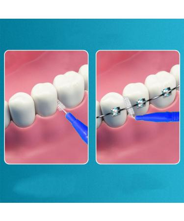 Interdental Brushes Blue - Soft Mini Toothbrushes for Effective Dental Care | Pack of 10 - Buy Online on GoSupps.com