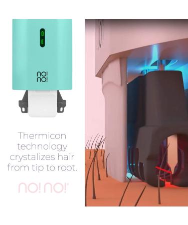 No!No! Micro Hair Removal Device - Mint - Bikini and Full Body Hair Remover for Women & Men - Buy Online on GoSupps.com