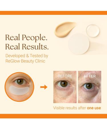 ReGlow Complete Anti-Aging & Radiance Kit Award Winning Stem Cell + Exosome Micro-Infusion System Bio-Collagen Overnight Mask & Micro-Infusion Eye Patches - Buy Online on GoSupps.com
