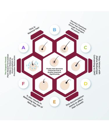 Organic Forest Red Onion Hair Oil 100ml - Chemical Free Hair Loss Treatment with Black Seed Oil for Hair Fall Control - Vegan & Plant Based Formula - Buy Online on GoSupps.com