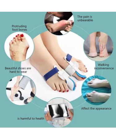 Keenso 2pcs Bunion Corrector & Toe Separators for Women - Universal Female Toe Splints for Overlapping Big Toe - Buy Online on GoSupps.com