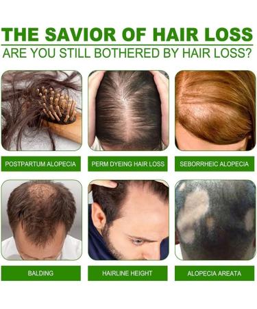 Hair Growth Serum for Men & Women - 120ml Hair Regrowth Lotion Anti Hair Loss Promotes Thicker Stronger Hair & Beard - 100% Natural Herbs - Buy Online on GoSupps.com