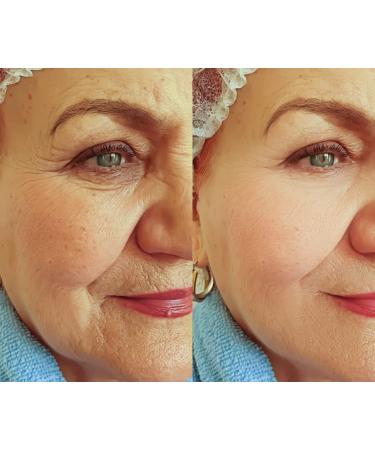 Neuropeptide & Growth Factor Wrinkle Serum - Brightening Antioxidant Collagen Peptides & Hyaluronic Acid for All Skin Types - Reduce Fine Lines & Premature Aging - 1oz - Buy Online on GoSupps.com