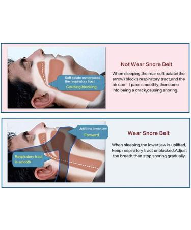 GOTOTOP Anti Snoring Strap - Adjustable & Durable Sleep Aid for Men & Women - Breathable, Washable Design for Mouth Breathers - Buy Online on GoSupps.com