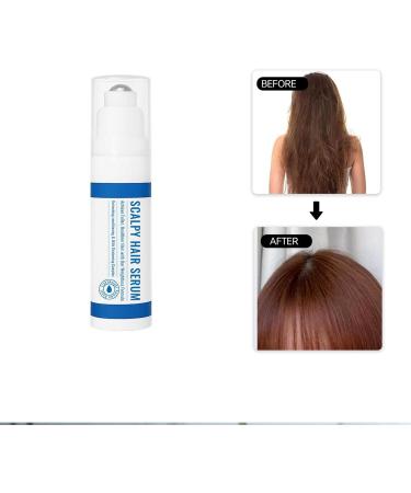  Yugugomo Anti-Frizz Hair Oil - 15ml Natural Liquid Roll-On - Scalp and Hair Growth Oil to Restore Thickness and Volume for Men and Women - Buy Online on GoSupps.com